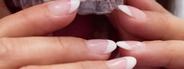 clear aligners singapore